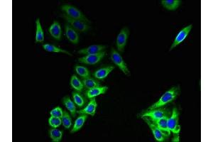 Immunofluorescent analysis of HepG2 cells using ABIN7147817 at dilution of 1:100 and Alexa Fluor 488-congugated AffiniPure Goat Anti-Rabbit IgG(H+L) (CMTM8 Antikörper  (AA 1-39))