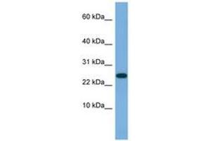Image no. 1 for anti-Ankyrin Repeat Domain 39 (ANKRD39) (AA 35-84) antibody (ABIN6745692) (ANKRD39 Antikörper  (AA 35-84))
