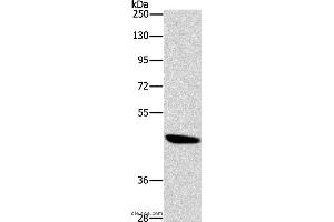 Western blot analysis of A172 cell, using BRS3 Polyclonal Antibody at dilution of 1:500 (BRS3 Antikörper)