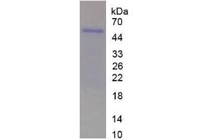 SDS-PAGE analysis of Rat WISP2 Protein. (WISP2 Protein)