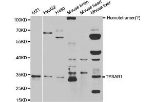 Western blot analysis of extracts of various cell lines, using TPSAB1 antibody. (TPSAB1 Antikörper)