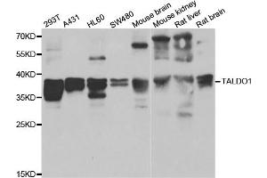 Western blot analysis of extracts of various cell lines, using TALDO1 antibody. (TALDO1 Antikörper)