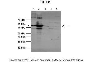 Lanes:   1:1ug insoluble STUB1 protein, 2:1ug soluble STUB1 protein, 3:1ug EPM2A protein, 4:1ug insoluble PPP1R3C protein, 5:1ug soluble PPP1R3C protein  Primary Antibody Dilution:   1:2500  Secondary Antibody:   Anti-rabbit-AP  Secondary Antibody Dilution:   1:20,000  Gene Name:   STUB1  Submitted by:   Pedro Castanheira, Biocant (STUB1 Antikörper  (C-Term))