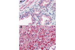 Immunohistochemical staining of formalin-fixed, paraffin-embedded human prostate (A) and human adrenal gland (B) tissue after heat-induced antigen retrieval. (CCKAR Antikörper  (Internal Region))
