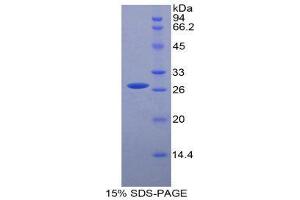 SDS-PAGE (SDS) image for Hepatocyte Growth Factor (Hepapoietin A, Scatter Factor) (HGF) (AA 482-710) protein (His tag) (ABIN2121233)