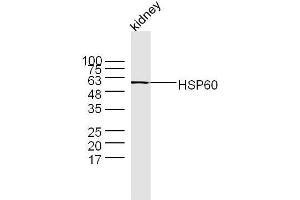 Mouse kidney lysates probed with Rabbit Anti-HSP60 Polyclonal Antibody  at 1:300 overnight at 4˚C.