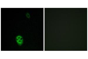 Immunofluorescence analysis of Jurkat cells, using OR4K17 antibody. (OR4K17 Antikörper  (C-Term))
