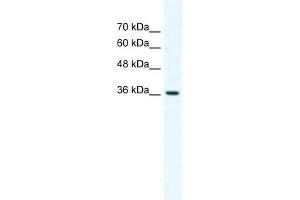 WB Suggested Anti-DVL1 Antibody Titration:  2. (DVL1 Antikörper  (Middle Region))