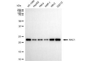 Western blotting analysis using RAC1 antibody (ABIN7800112).