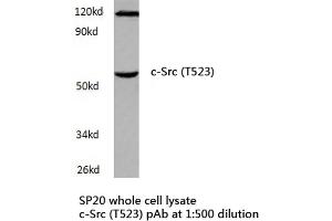 Western blot (WB) analyzes of c-Src antibody in extracts from SP20 cells. (NCOA1 Antikörper)