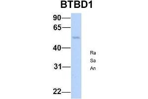 Host:  Rabbit  Target Name:  BTBD1  Sample Type:  Human Fetal Lung  Antibody Dilution:  1. (BTBD1 Antikörper  (N-Term))