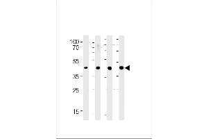 SRD5A3 Antibody (C-term) (ABIN651469 and ABIN2840258) western blot analysis in 293,LNCaP,PC-3,NCI- cell line lysates (35 μg/lane). (SRD5A3 Antikörper  (C-Term))