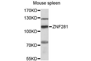 Western blot analysis of extracts of mouse spleen, using ZNF281 antibody (ABIN6291078) at 1:3000 dilution. (ZNF281 Antikörper)