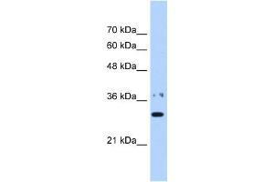 WB Suggested Anti-NMNAT1 Antibody Titration:  0. (NMNAT1 Antikörper  (N-Term))