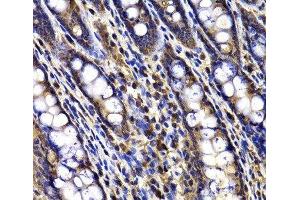 Immunohistochemistry of paraffin-embedded Rat ileum using ARID3A Polyclonal Antibody at dilution of 1:100 (40x lens). (ARID3A Antikörper)