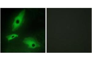 Immunofluorescence analysis of HeLa cells, using LTBR Antibody. (LTBR Antikörper  (AA 11-60))