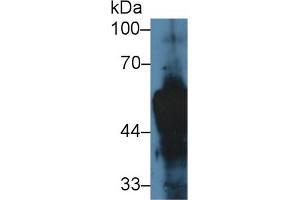 Western blot analysis of Rat Skin lysate, using Rat KRT14 Antibody (5 µg/ml) and HRP-conjugated Goat Anti-Rabbit antibody ( (KRT14 Antikörper  (AA 122-429))