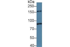 Western Blot; Sample: Mouse Small intestine lysate; Primary Ab: 1µg/ml Rabbit Anti-Mouse PLCb3 Antibody Second Ab: 0. (PLCB3 Antikörper  (AA 318-468))