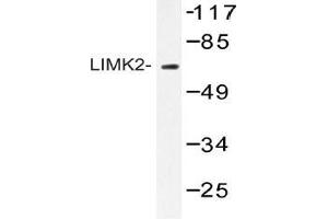 Western blot (WB) analysis of AP20423PU-N LIMK2 antibody in extracts from HepG2 cells. (LIMK2 Antikörper)
