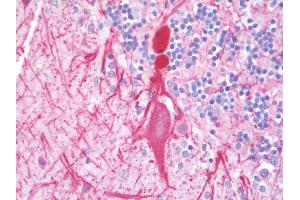 Anti-NEFH / NF-H antibody IHC staining of human brain, cerebellum.