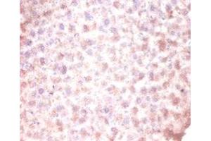 Immunohistochemistry of paraffin-embedded mouse liver tissue using ABIN7147238 at dilution of 1:100 (CDKN2AIPNL Antikörper  (N-Term))