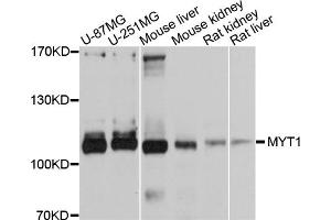 Western blot analysis of extracts of various cell lines, using MYT1 antibody. (MYT1 Antikörper)