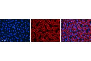 HADH antibody - C-terminal region (ARP54765_P050) Catalog Number: ARP54765_P050  Formalin Fixed Paraffin Embedded Tissue: Human Liver Tissue  Observed Staining: Cytoplasm in mitochondria of hepatocytes Primary Antibody Concentration: 1:600  Secondary Antibody: Donkey anti-Rabbit-Cy3  Secondary Antibody Concentration: 1:200  Magnification: 20X  Exposure Time: 0.