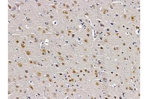 ABIN6261786 and ABIN6279146 at 1/100 staining rat brain tissue by IHC-P. (A2BP1 Antikörper  (N-Term))