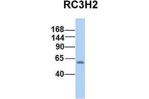 Host:  Rabbit  Target Name:  RC3H2  Sample Type:  Human Fetal Lung  Antibody Dilution:  1. (RC3H2 Antikörper  (Middle Region))