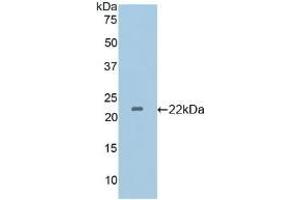 Detection of Recombinant GP4, Mouse using Polyclonal Antibody to Cluster Of Differentiation 36 (CD36) (CD36 Antikörper  (AA 45-203))