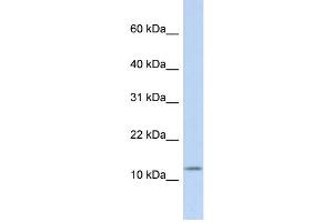 WB Suggested Anti-CCK Antibody Titration:  0.