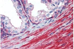 Immunohistochemistry (Formalin-fixed Paraffin-embedded Sections) (IHC (fp)) image for anti-Myosin Light Chain 6, Alkali, Smooth Muscle and Non Muscle (MYL6) (AA 72-121) antibody (ABIN6744460)