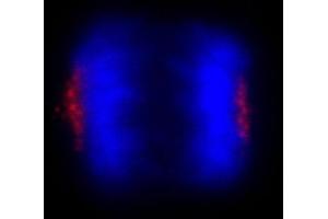 anti-Centrosomal Protein 170kDa (CEP170) (C-Term) antibody