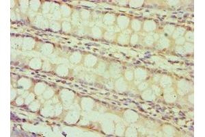 Immunohistochemistry of paraffin-embedded human colon tissue using ABIN7145641 at dilution of 1:100 (BAMBI Antikörper  (AA 21-152))