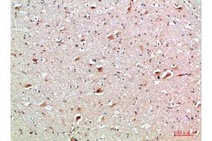 Immunohistochemical analysis of paraffin-embedded human-brain, antibody was diluted at 1:200 (CD137 Antikörper  (AA 111-160))