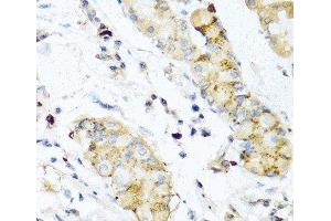Immunohistochemistry of paraffin-embedded Human stomach using IFNL3 Polyclonal Antibody at dilution of 1:100 (40x lens). (IL28B Antikörper)