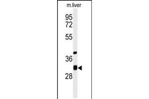 Western blot analysis of ECHDC1 Antibody in mouse liver tissue lysates (35ug/lane) (ECHDC1 Antikörper  (C-Term))