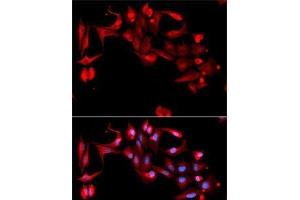 Immunofluorescence analysis of A-549 cells using GP9 Polyclonal Antibody