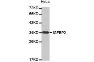 Western Blotting (WB) image for anti-Insulin-Like Growth Factor Binding Protein 2, 36kDa (IGFBP2) antibody (ABIN2650925) (IGFBP2 Antikörper)