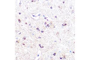 Immunohistochemistry of paraffin-embedded mouse spinal cord using IDO1 Rabbit mAb (ABIN7267863) at dilution of 1:100 (40x lens). (IDO1 Antikörper)