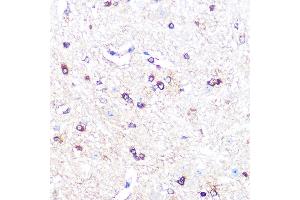 Immunohistochemistry of paraffin-embedded mouse spinal cord using IDO1 Rabbit mAb (ABIN7267863) at dilution of 1:100 (40x lens).