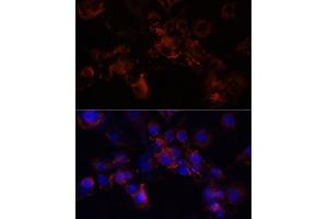 Immunofluorescence analysis of NIH/3T3 cells using STXBP1 antibody (ABIN6128255, ABIN6148673, ABIN6148674 and ABIN6221073) at dilution of 1:100 (40x lens). (STXBP1 Antikörper  (AA 295-594))