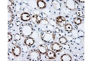 Immunohistochemistry (IHC) image for anti-Proteasome (Prosome, Macropain) 26S Subunit, ATPase, 3 (PSMC3) antibody (ABIN1501331) (PSMC3 Antikörper)