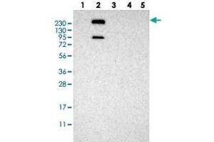 Western blot analysis of Lane 1: RT-4, Lane 2: U-251 MG, Lane 3: Human Plasma, Lane 4: Liver, Lane 5: Tonsil with MPDZ polyclonal antibody .