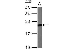 Peroxiredoxin 1 Antikörper