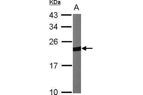 Peroxiredoxin 1 Antikörper