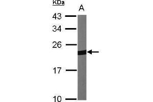 WB Image Sample (30 ug of whole cell lysate) A:NIH-3T3 12% SDS PAGE antibody diluted at 1:1000 (Peroxiredoxin 1 Antikörper)