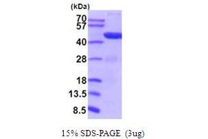 SDS-PAGE (SDS) image for Phosphoglycerate Kinase 1 (PGK1) (AA 1-4170) (Active) protein (His tag) (ABIN5854214) (PGK1 Protein (AA 1-4170) (His tag))