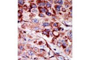 Image no. 2 for anti-Adenylate Kinase 2 (AK2) (C-Term) antibody (ABIN360625) (Adenylate Kinase 2 Antikörper  (C-Term))