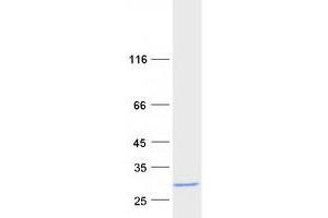 Validation with Western Blot (beta Synuclein Protein (Transcript Variant 1) (Myc-DYKDDDDK Tag))